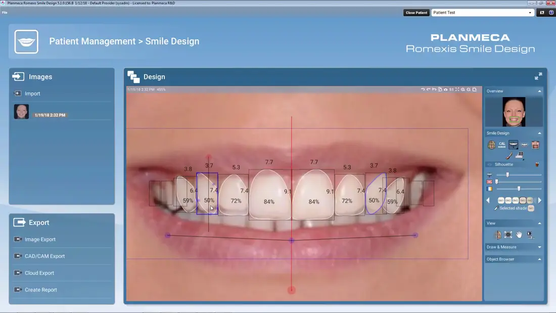 Smile Design App Or Software For Dentist
